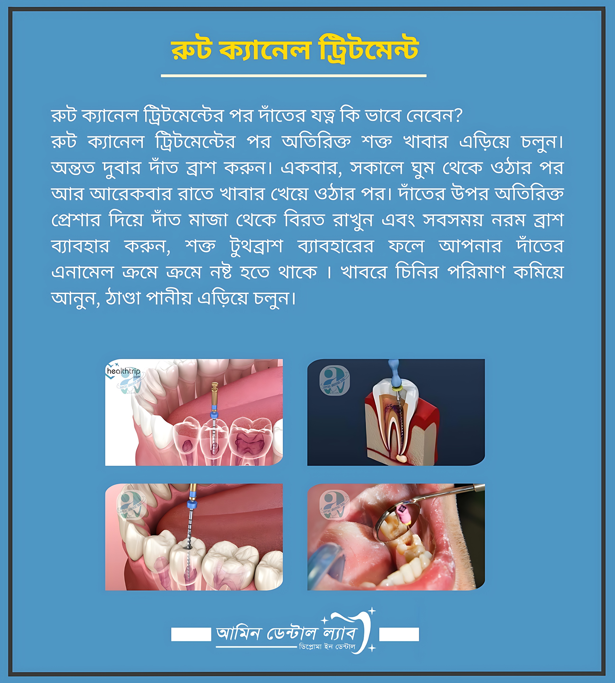 ক্রাউন ব্রীজ ক্যাপ