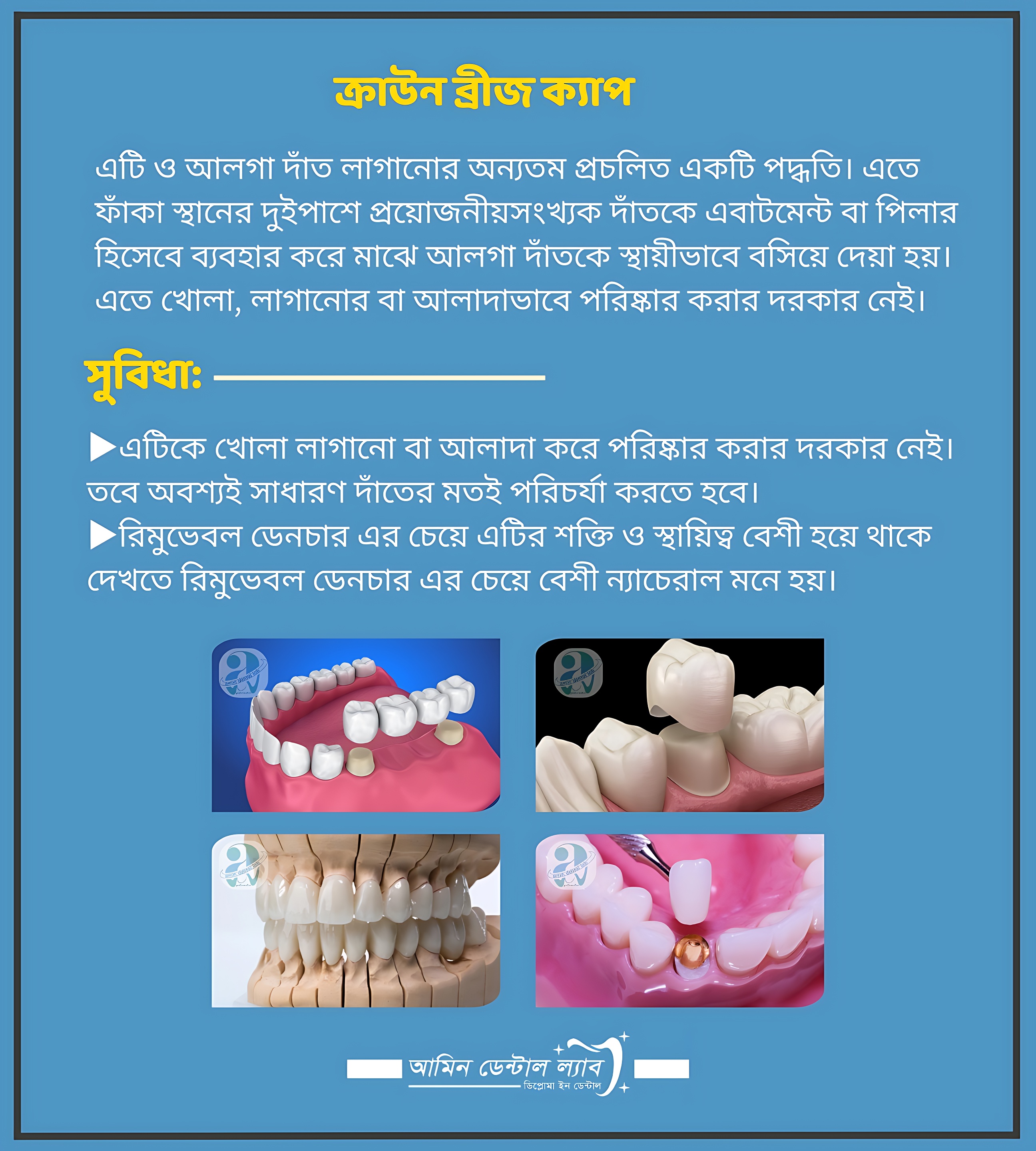 ক্রাউন ব্রীজ ক্যাপ